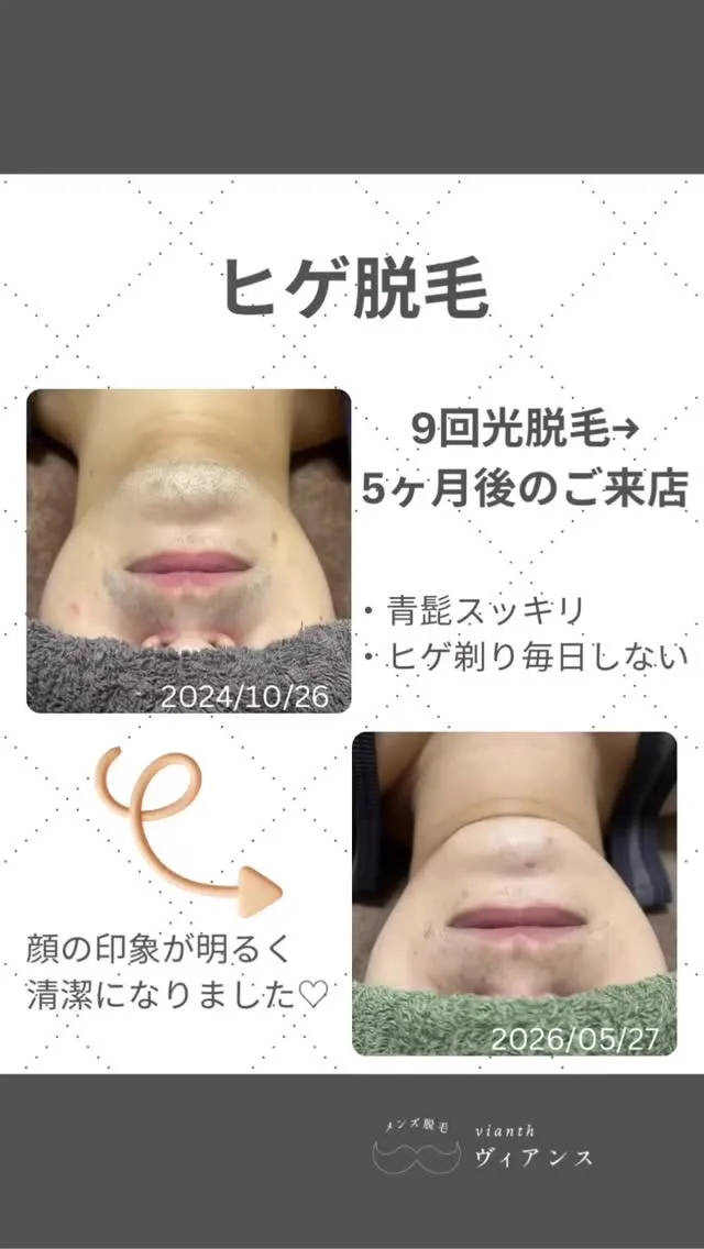 初回ご来店時と比べると、